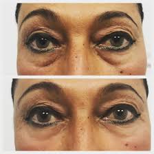 Dr. Francesco D'Angelo