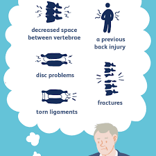Facet Arthropathy Arthritis Of The Back