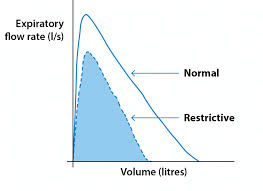 spirometry and reversibility testing british lung foundation