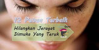 Cara menghilangkan flek hitam dan bekas jerawat. 12 Petua Terbaik Hilangkan Jeragat Dimuka Yang Teruk Cubalah Nutrisi Guru