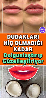 Dudaklari Dolgunlastirip Guzellestirme Https Kathyblades Topwomentrends Com P 1503 Bestlips Vaseline Beauty Tips Simple Eye Makeup Beauty Tips For Hair