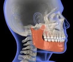 Image result for Osteomyelitis
