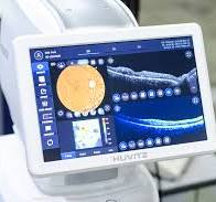 Optische Kohärenztomographie | Edmund Optics