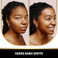 VALITIC 2 Pack Kojic Acid Vitamin C & Retinol Soap Bars for Dark Spot  Bundle with 2 Turquoise Exfoliating Gloves for Body Scrubs : Amazon.com.au:  Everything Else