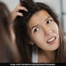 Fifteen bucks for women's cuts, ten for guys. Neem For Hair 6 Natural Ways To Keep Dandruff At Bay Ndtv Food