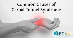 That in turn is cased many times, there is no single cause of carpal tunnel syndrome. Common Causes Of Carpal Tunnel Syndrome Pt Me