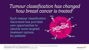 Describe the recommended medical treatment for hereditary breast cancer estimated time to complete. Astrazeneca On Twitter Breastcancer Is One Of The Four Core Disease Areas Of Our Oncology Research We Are Committed To Pursuing Innovative Approaches To Change The Clinical Paradigm And To Improve Treatment