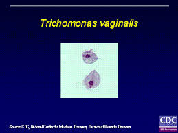 Image result for trichomonas images