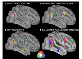 Looking for the definition of rtpj? Rethinking The Role Of The Rtpj In Attention And Social Cognition In Light Of The Opposing Domains Hypothesis Findings From An Ale Based Meta Analysis And Resting State Functional Connectivity Semantic Scholar