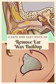 5 Home Remedies To Remove Ear Wax Ear Wax Buildup Ear Wax Ear Cleaning