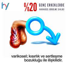 varikosel testislerden gelen korkutucu agri hekimim yanimda korkutucu gencler saglikli yasam