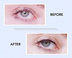 A wide variety of tattoo makeup eyeliner options are available to you, such as form, feature, and ingredient. Eyeliner Tattoos Permanent Eyeliner Benefits Risks Cost