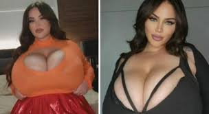 Onlyfans, la modella: «Il mio seno cresce a dismisura per una malattia. Ho  gli occhi degli uomini addosso»