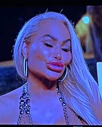 Criticism of Darcey's Appearance