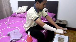 Part 4 Pesakit Yang Berbalut Di Tangan Youtube