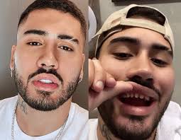 Para este procedimento, você precisa de um pincel especial, colar e enxaguar. Kevinho Choca Ao Aparecer Sem As Lentes De Contato Dos Dentes Fofocas E Famosos