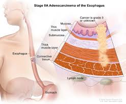 Image result for esophagus