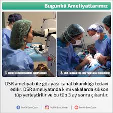 Dsr Ameliyati Ile Goz Yasi Kanal Tikanikligi Tedavi Edilir Dsr Ameliyatinda Kimi Vakalarda Silikon Tup Yerlestirilir Ve Bu Tup 3 Ay Sonra C Bilgi Kanal Gozler