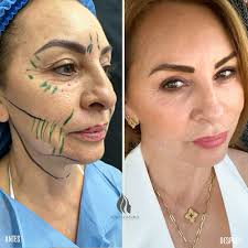 𝐃𝐑 𝐍𝐎𝐑𝐀 𝐒𝐓𝐀𝐍𝐅𝐎𝐑𝐃 𝐏𝐥𝐚𝐬𝐭𝐢𝐜 S𝐮𝐫𝐠𝐞𝐨𝐧