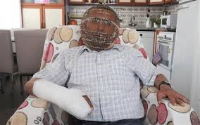 Scopri ricette, idee per la casa, consigli di stile e altre idee da provare. Turkish Man Wears Helmet Like Head Cage To Quit Smoking Turkey News