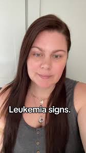 Recognizing Leukemia Signs: Understanding Bruising Patterns
