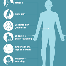 Liver function test (lft) increase is an early sign of acetaminophen (apap) toxicity. Transaminitis Symptoms Causes Diagnosis And Treatment