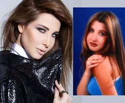 الحرص على اختيار طبيب التجميل ذي السمعة الجيدة، والخبرة الكبيرة في مجاله، مع التأكّد من أنّه حاصل على شهادات معتمدة. Ø¨Ø§Ù„ØµÙˆØ± ÙÙ†Ø§Ù†Ø§Øª Ù‚Ø¨Ù„ ÙˆØ¨Ø¹Ø¯ Ø¹Ù…Ù„ÙŠØ§Øª ØªØ¬Ù…ÙŠÙ„ Ø§Ù„Ø£Ù†Ù Ù…Ø¬Ù„Ø© Ù‡ÙŠ