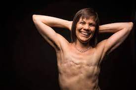 Diff, her mother unexpectedly died, she went through a breakup, and then she was diagnosed with bilateral breast cancer. For Queer Cancer Survivors It S Not All About Pink Ribbons Amnewyork