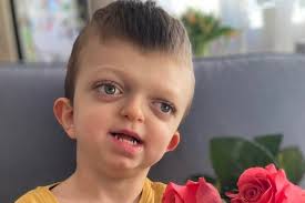 Gorzów. Adaś Kos jest już po dwóch operacjach w Dallas. Teraz wymaga  rehabilitacji. Podaruj chłopcu 1 proc. i pomóż mu w powrocie do zdrowia