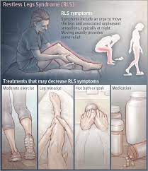 Restless Legs Syndrome Gets A Real Starting Point For Potential Treatments Restless Leg Syndrome Restless Legs Restless Leg Remedies