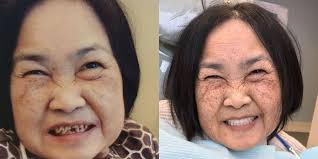 Transformative Dental Before & After