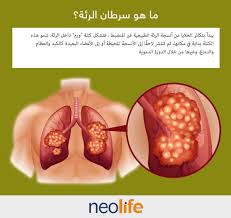 ولأن البروستاتا تقع مباشرة تحت المثانة وتحيط بقناة مجرى البول فإن تضخمها سيؤثر إن عودة البروستاتا للنمو بعد سن الأربعين أمر غير وضاح الأسباب ولكن يعتبر الخبراء ان. Ø¯Ø¹Ù… Ù…Ø§Ù„ÙŠ Ø¹Ù„Ù‰ Ù†Ø·Ø§Ù‚ ÙˆØ§Ø³Ø¹ Ù…Ø­Ø±Ø§Ø« Ø§Ø¹Ø±Ø§Ø¶ Ø³Ø±Ø·Ø§Ù† Ø§Ù„Ø¨Ø±ÙˆØ³ØªØ§ØªØ§ Ù„Ù„Ù†Ø³Ø§Ø¡ Brielarsonbrasil Com