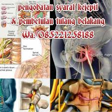 Rumah Terapy Ahli Pijat Syaraf Kejepit Bandung Pengobatan Syaraf Kejepit Bandung Alternatif Saraf Perasaan Bagian Tubuh Tulang