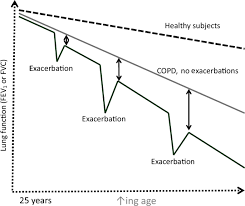 Image result for COPD Exacerbation Prevention