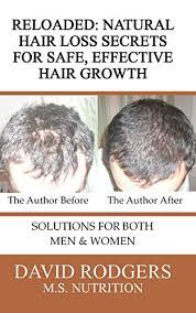 Hair loss, or alopecia, is a concern for men, women, and children. Reloaded Natural Hair Loss Secrets For Safe Effective Hair Growth Buy Online In Andorra At Andorra Desertcart Com Productid 1702438