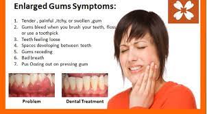 Few Symptoms That Indicate Enlarged Gums Dental Treatment Receding Gums Swollen Gum
