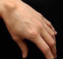 Ganglion cyst - Wikipedia