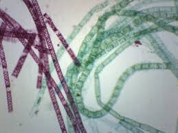 Please subscribe, like and comment. Vegetative Spirogyra Prepared Microscope Slide 75x25mm Eisco Labs