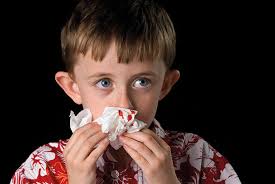 Colds may also irritate the lining of the nose. Managing Epistaxis In Children Gponline