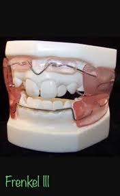 Azize Adli Kullanicinin Orthodontic Treatment Panosundaki Pin Goruntuler Ile