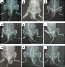Image result for Holarrhena floribunda