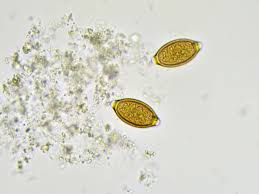 Image result for Whipworm