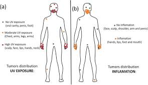 Lesions are described as pearly raised bumps (papules) that often appear on areas of the skin usually exposed to sunlight. Assessment Of The Risk And Characterization Of Non Melanoma Skin Cancer In Kindler Syndrome Study Of A Series Of 91 Patients Orphanet Journal Of Rare Diseases Full Text