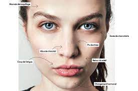 En revanche, en le pressant sans arrêt, la bactérie ne fait que se propager, l'inflammation arrive alors plus vite que prévu, et le bouton devient plus gros. 5 Types De Boutons Et Comment Les Traiter Elle Quebec