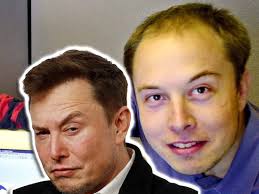 Peppermint oil and ginko biloba leaf extract encourage. Elon Musk Hair Transplant History And Hair Analysis Before And After