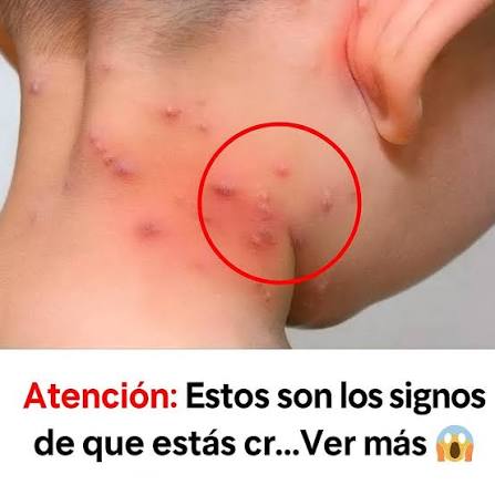 Conoces los principales tipos de erupciones en la piel? Descubre cuáles son  y qué las causa.👇