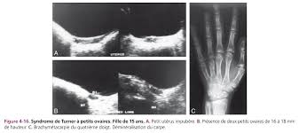 Il y des moments où le mot non devient le plus beau mot de. Comment Realiser Une Echographie Pelvienne De L Enfant Et De L Adolescente