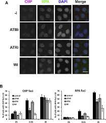 Wearable that boosts your focus. Novel Characteristics Of Ctip At Damage Induced Foci Following The Initiation Of Dna End Resection Sciencedirect