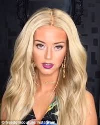 Perth model with Alopecia areata shares video of herself without a wig