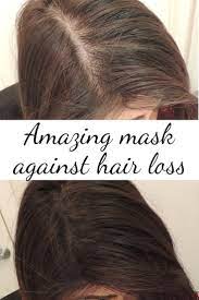 Coconut oil moisturizes the scalp and hair, protecting them from sun, wind, pollution, and other damaging impurities. Amazing Amla And Coconut Oil Hair Mask To Control Hair Fall Hair Control Hair Treatment Hair Loss